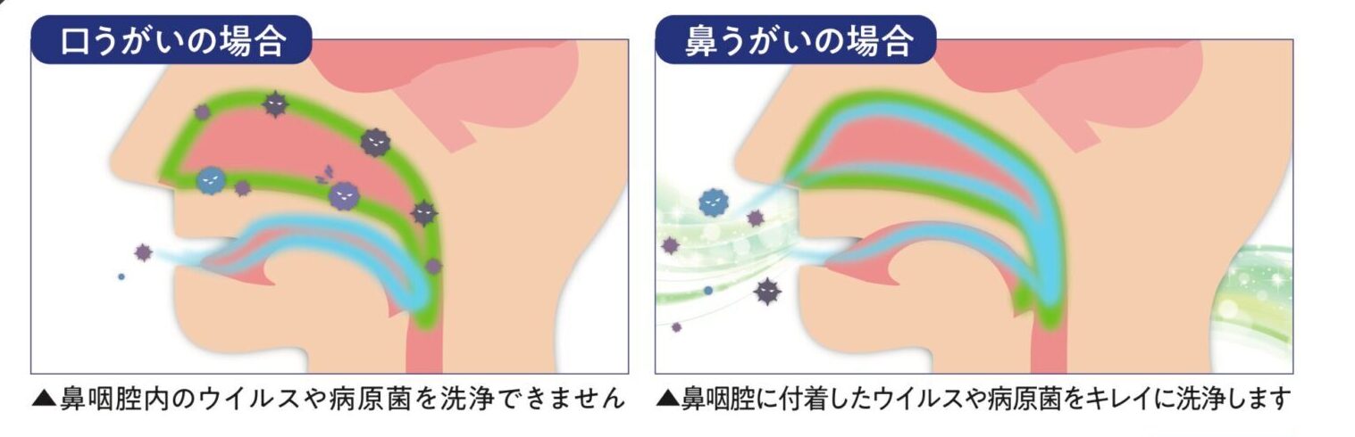 口うがいと鼻うがいの違い